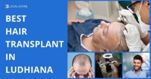 Best Hair Transplant in Ludhiana